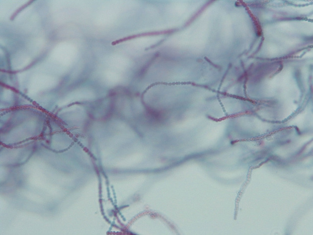 Anabaena Slides - Anabaena 08 200X